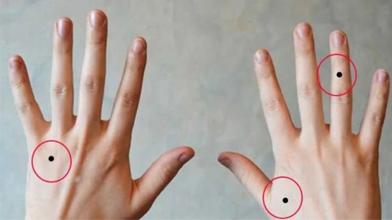 Giải mã ý nghĩa nốt ruồi trong lòng bàn tay liên quan vận mệnh